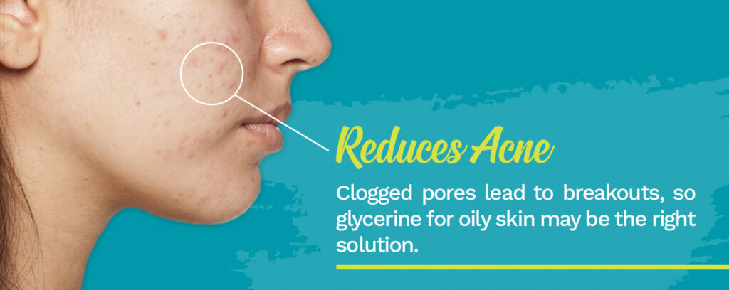 Clogged pores lead to breakouts, glycerine may be the solution