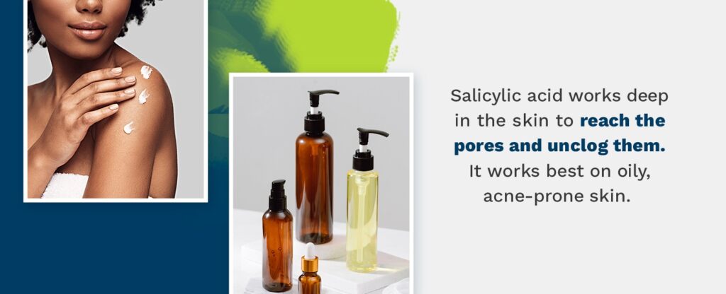 Salicylic acid works deep in the skin to reach the pores and unclog them